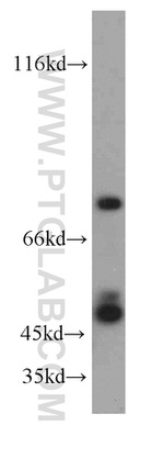 SH3BP1 Antibody in Western Blot (WB)