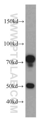 SH3BP1 Antibody in Western Blot (WB)