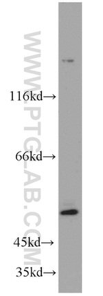 SH3BP1 Antibody in Western Blot (WB)