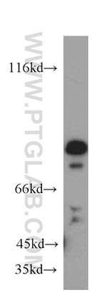 SH3BP1 Antibody in Western Blot (WB)