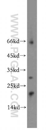 NUDT3 Antibody in Western Blot (WB)