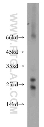 NUDT3 Antibody in Western Blot (WB)