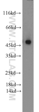 DDDDK Tag Antibody in Western Blot (WB)