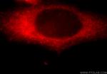 KANK2 Antibody in Immunocytochemistry (ICC/IF)