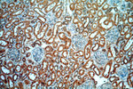 KANK2 Antibody in Immunohistochemistry (Paraffin) (IHC (P))