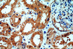 KANK2 Antibody in Immunohistochemistry (Paraffin) (IHC (P))