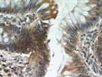 KANK2 Antibody in Immunohistochemistry (Paraffin) (IHC (P))