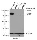 TOP2B Antibody in Western Blot (WB)