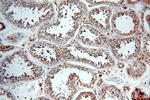 SLC16A12 Antibody in Immunohistochemistry (Paraffin) (IHC (P))
