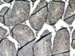 PARP2 Antibody in Immunohistochemistry (Paraffin) (IHC (P))