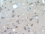 PARP2 Antibody in Immunohistochemistry (Paraffin) (IHC (P))