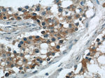 CBLN4 Antibody in Immunohistochemistry (Paraffin) (IHC (P))