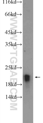 CBLN4 Antibody in Western Blot (WB)