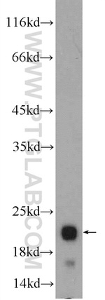 CBLN4 Antibody in Western Blot (WB)