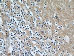 CBLN4 Antibody in Immunohistochemistry (Paraffin) (IHC (P))