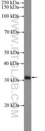 HOXD9 Antibody in Western Blot (WB)
