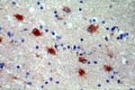 STXBP1 Antibody in Immunohistochemistry (Paraffin) (IHC (P))