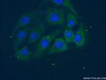 PAFAH1B3 Antibody in Immunocytochemistry (ICC/IF)