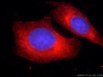 DICER1 Antibody in Immunocytochemistry (ICC/IF)