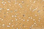 DOC2A Antibody in Immunohistochemistry (Paraffin) (IHC (P))