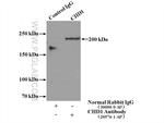CHD1 Antibody in Immunoprecipitation (IP)