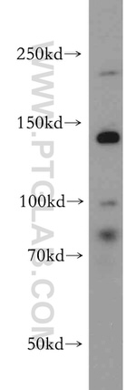 CHD1 Antibody in Western Blot (WB)