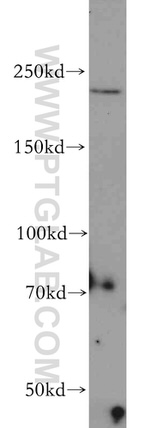 CHD1 Antibody in Western Blot (WB)