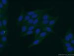 APOB Antibody in Immunocytochemistry (ICC/IF)