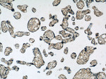 PERK/EIF2AK3 Antibody in Immunohistochemistry (Paraffin) (IHC (P))