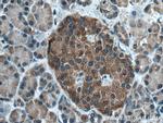 PERK/EIF2AK3 Antibody in Immunohistochemistry (Paraffin) (IHC (P))