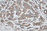 PERK/EIF2AK3 Antibody in Immunohistochemistry (Paraffin) (IHC (P))