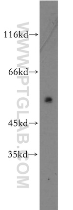SSTR1 Antibody in Western Blot (WB)
