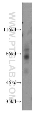 SSTR1 Antibody in Western Blot (WB)