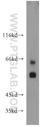 SSTR1 Antibody in Western Blot (WB)