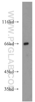 SSTR1 Antibody in Western Blot (WB)