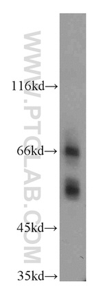 SSTR1 Antibody in Western Blot (WB)