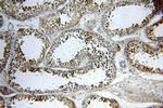 AIM2 Antibody in Immunohistochemistry (Paraffin) (IHC (P))