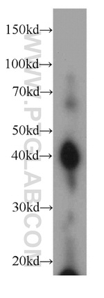 AIM2 Antibody in Western Blot (WB)