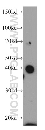AIM2 Antibody in Western Blot (WB)
