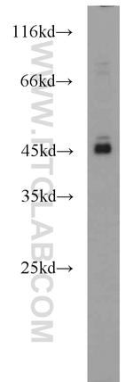 AIM2 Antibody in Western Blot (WB)