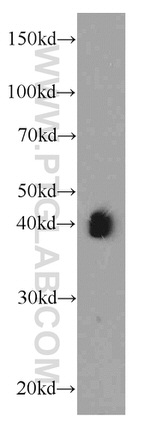 AIM2 Antibody in Western Blot (WB)