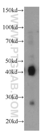 AIM2 Antibody in Western Blot (WB)