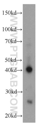 AIM2 Antibody in Western Blot (WB)