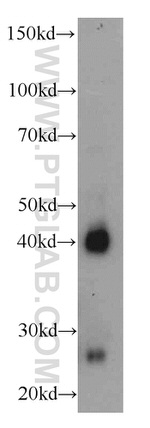 AIM2 Antibody in Western Blot (WB)