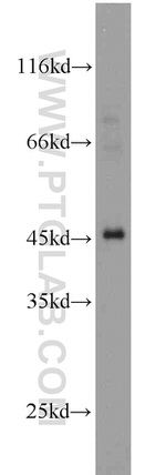 AIM2 Antibody in Western Blot (WB)