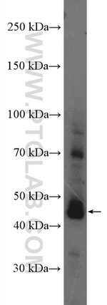 AIM2 Antibody in Western Blot (WB)