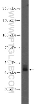 AIM2 Antibody in Western Blot (WB)