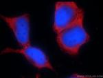 ORAI2 Antibody in Immunocytochemistry (ICC/IF)