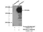 POLR1A Antibody in Immunoprecipitation (IP)