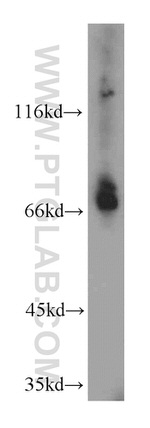 BTN2A1 Antibody in Western Blot (WB)